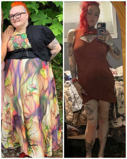 156 lbs Weight Loss Before and After 5'5 Female 312 lbs to 156 lbs