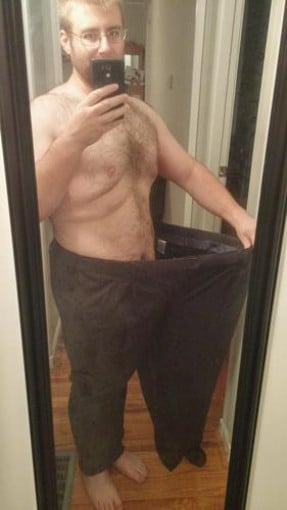 A before and after photo of a 5'11" male showing a weight reduction from 430 pounds to 235 pounds. A total loss of 195 pounds.