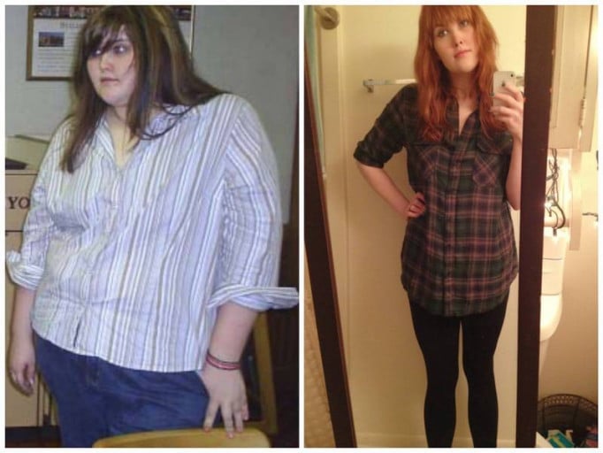 A photo of a 5'9" woman showing a weight loss from 330 pounds to 165 pounds. A net loss of 165 pounds.