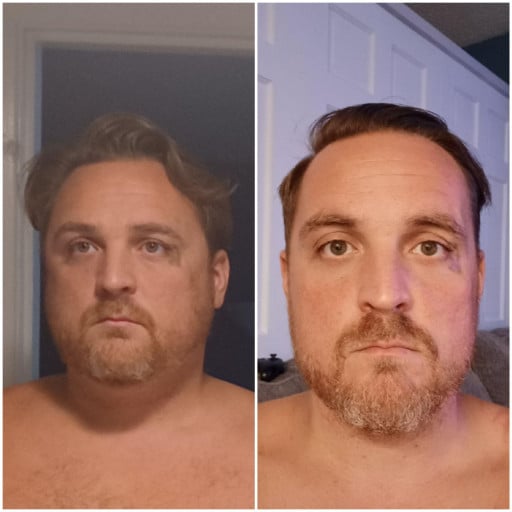 A before and after photo of a 6'0" male showing a weight reduction from 265 pounds to 236 pounds. A respectable loss of 29 pounds.
