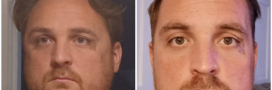6 foot Male Progress Pics of 29 lbs Fat Loss 265 lbs to 236 lbs