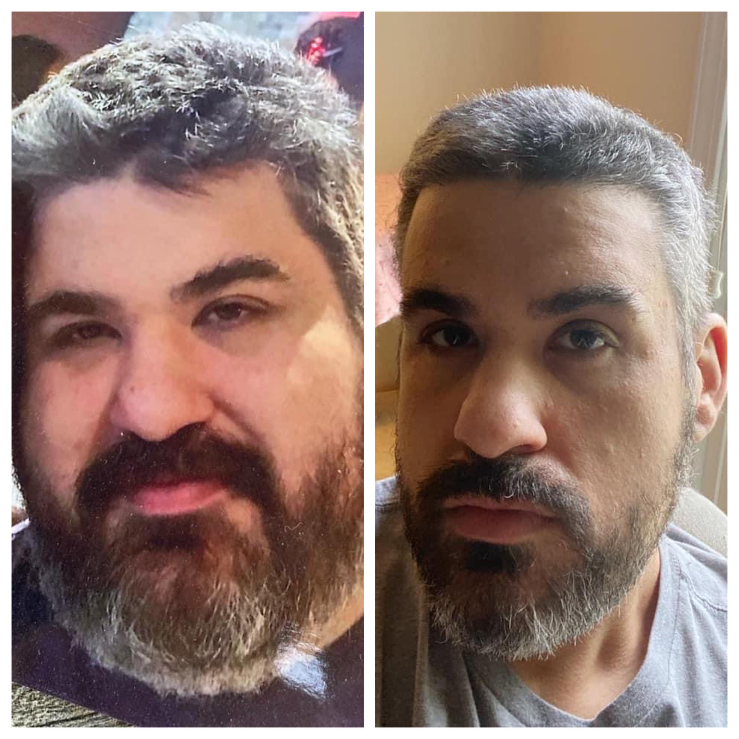 Progress Pics of 177 lbs Fat Loss 5'11 Male 365 lbs to 188 lbs