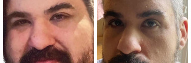 5'11 Male 177 lbs Weight Loss 365 lbs to 188 lbs