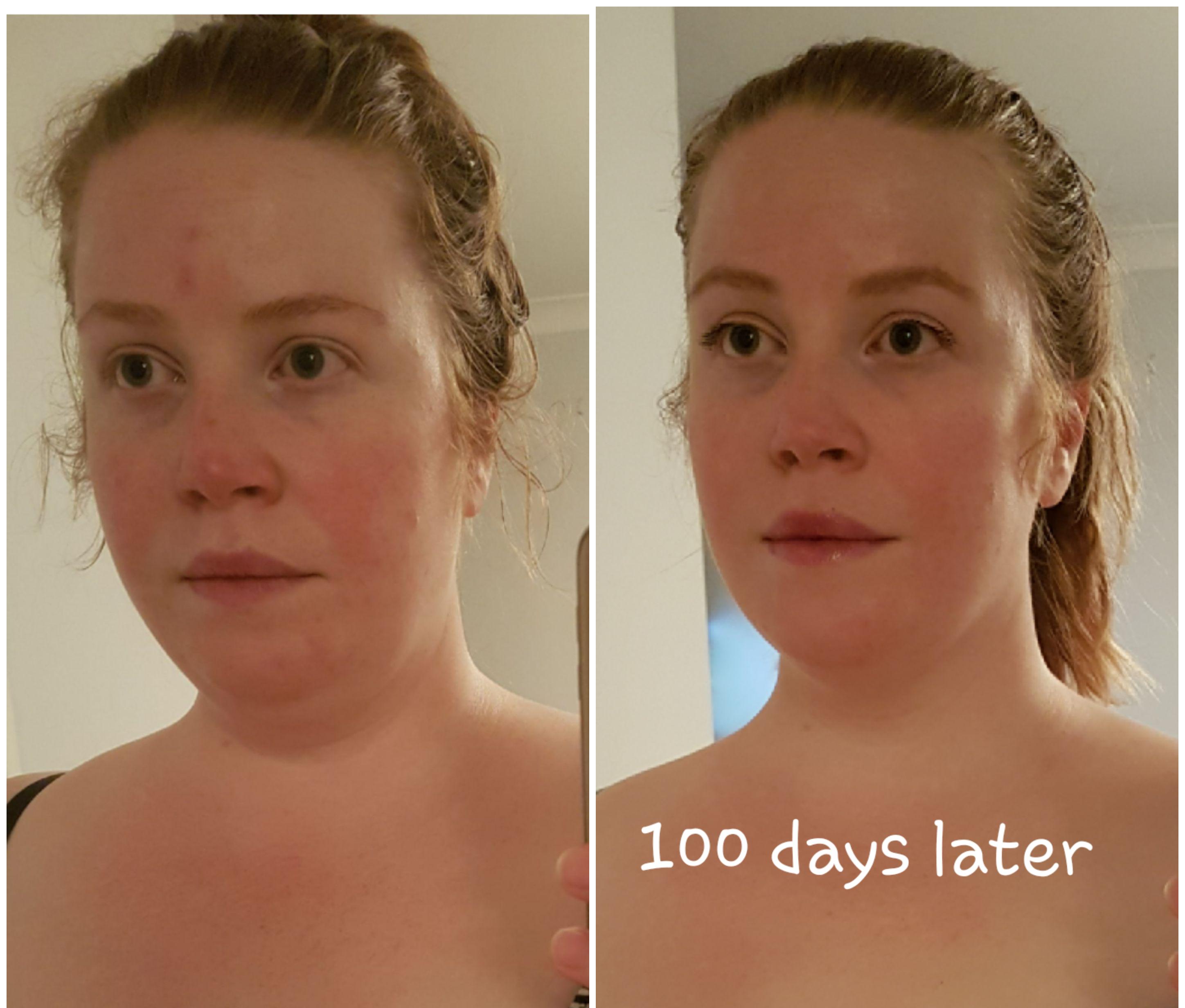 5'4 Female 40 lbs Weight Loss 294 lbs to 254 lbs
