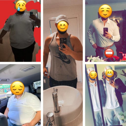 A before and after photo of a 6'0" male showing a weight reduction from 440 pounds to 260 pounds. A net loss of 180 pounds.