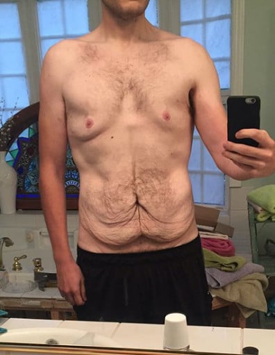 A before and after photo of a 6'1" male showing a fat loss from 374 pounds to 182 pounds. A respectable loss of 192 pounds.