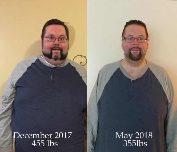 6 feet 3 Male 100 lbs Weight Loss Before and After 455 lbs to 355 lbs