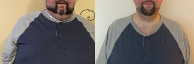 6 feet 3 Male 100 lbs Weight Loss Before and After 455 lbs to 355 lbs