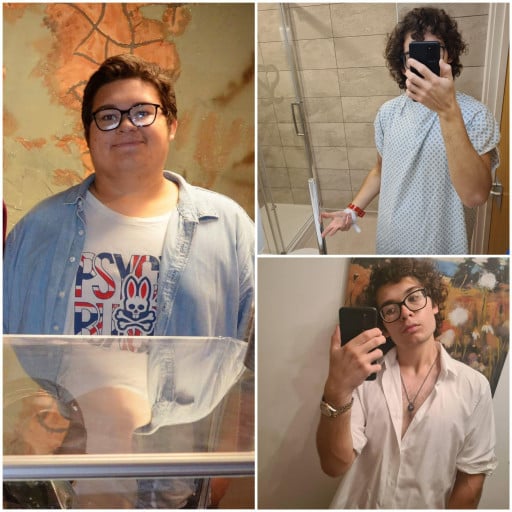 A progress pic of a 6'1" man showing a fat loss from 340 pounds to 161 pounds. A net loss of 179 pounds.