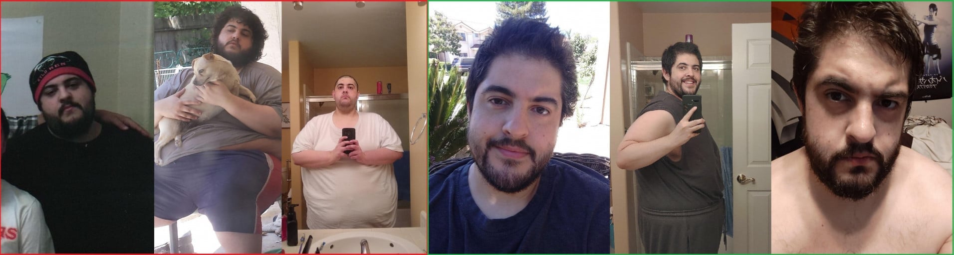 200 lbs Fat Loss Before and After 6 foot Male 520 lbs to 320 lbs