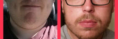 100 lbs Fat Loss Before and After 6 foot 5 Male 382 lbs to 282 lbs