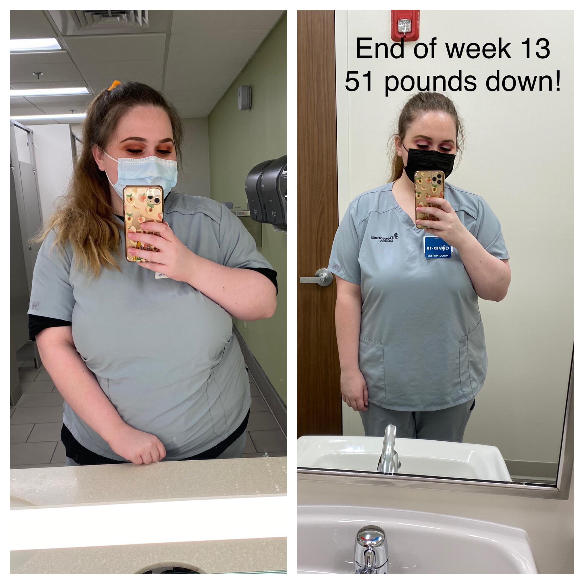 5'7 Female 51 lbs Fat Loss Before and After 286 lbs to 235 lbs