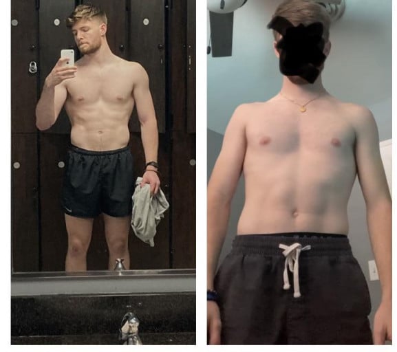 M/21/6’1” [165lbs > 193lbs = 28lbs] (1 year) from post surgery to post workout :)