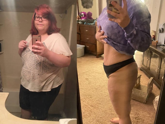A picture of a 5'5" female showing a weight loss from 300 pounds to 165 pounds. A net loss of 135 pounds.