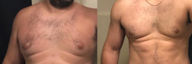 5 feet 9 Male 60 lbs Weight Loss Before and After 240 lbs to 180 lbs