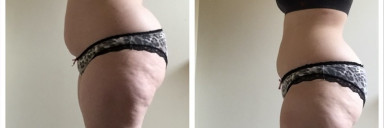 30 lbs Fat Loss Before and After 4 feet 11 Female 178 lbs to 148 lbs