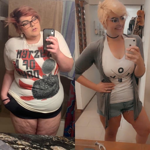 A before and after photo of a 5'11" female showing a weight reduction from 330 pounds to 199 pounds. A respectable loss of 131 pounds.