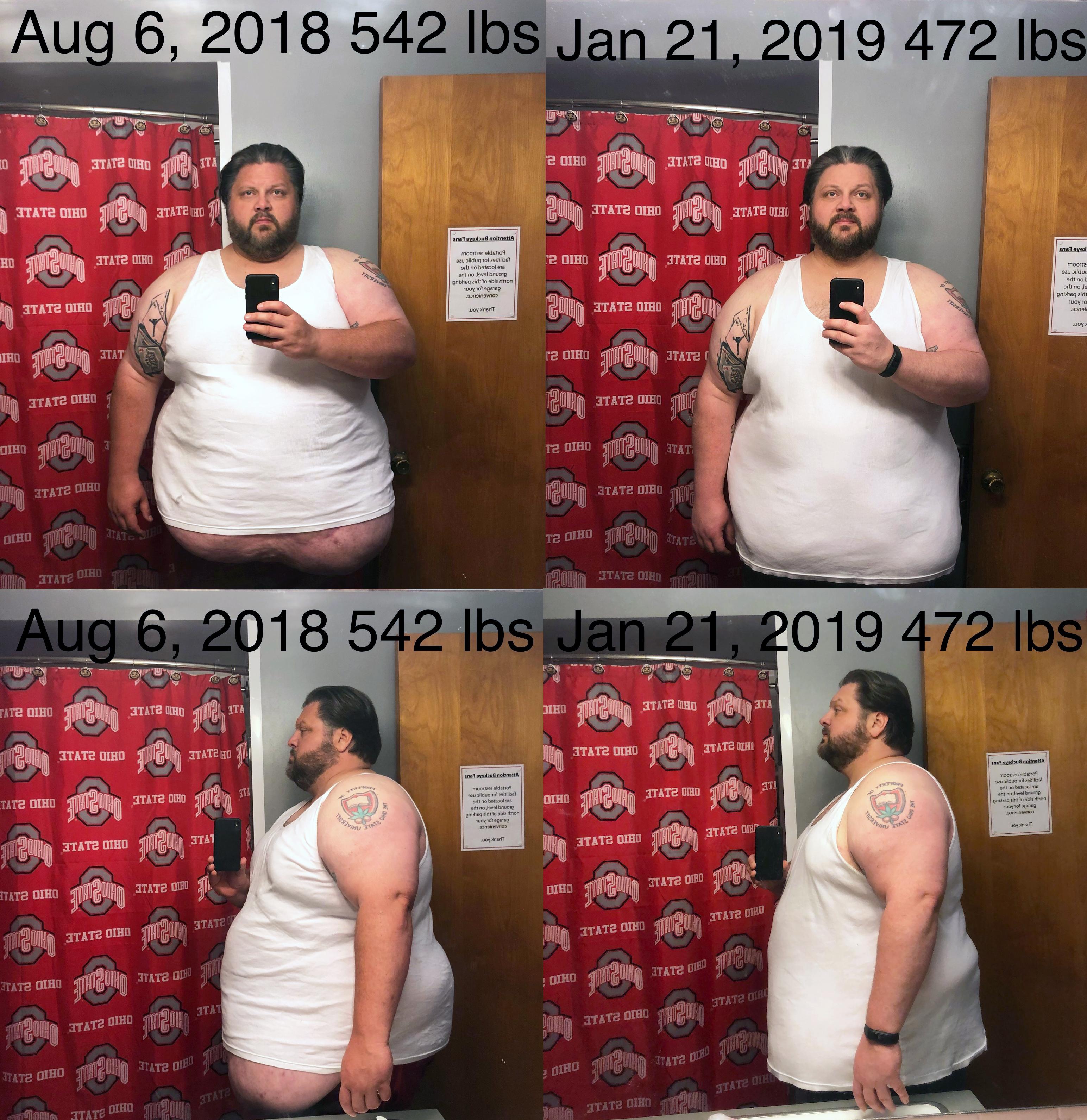 Progress Pics of 70 lbs Fat Loss 6 feet 1 Male 542 lbs to 472 lbs