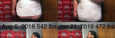 Progress Pics of 70 lbs Fat Loss 6 feet 1 Male 542 lbs to 472 lbs