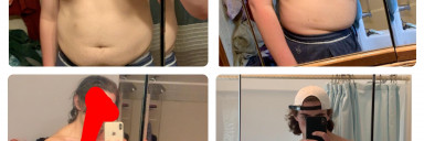 6 foot 4 Male Before and After 140 lbs Weight Loss 320 lbs to 180 lbs