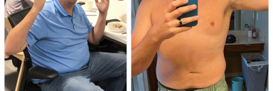 Progress Pics of 85 lbs Weight Loss 6 foot 7 Male 317 lbs to 232 lbs