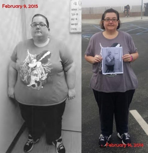 A before and after photo of a 5'2" female showing a weight reduction from 397 pounds to 257 pounds. A total loss of 140 pounds.