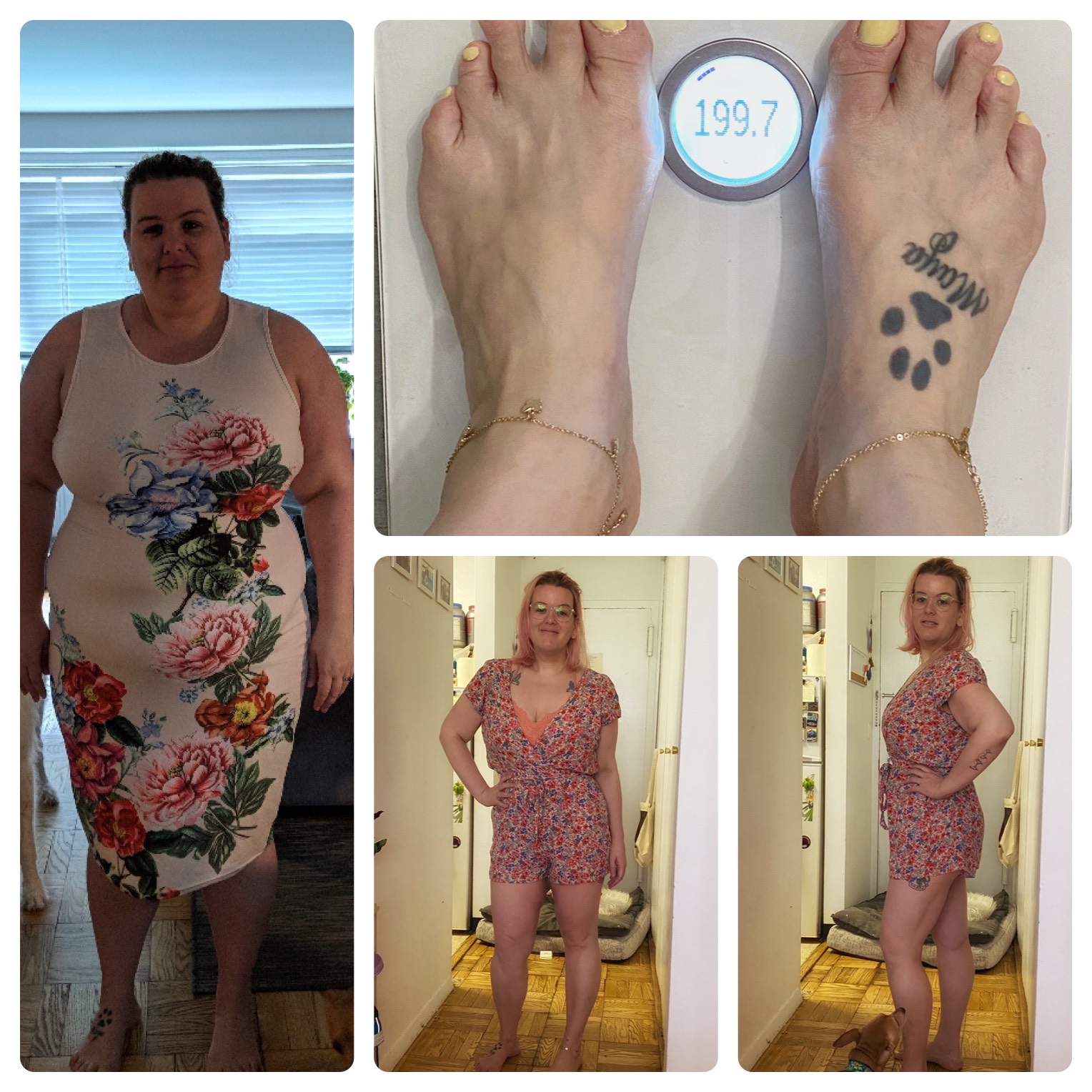 5 feet 8 Female Before and After 116 lbs Fat Loss 315 lbs to 199 lbs