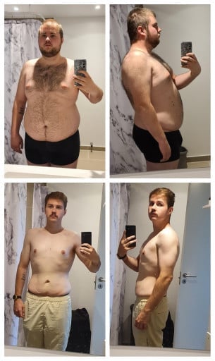 A before and after photo of a 5'11" male showing a weight reduction from 290 pounds to 187 pounds. A net loss of 103 pounds.