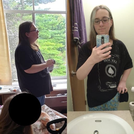 A picture of a 5'7" female showing a weight loss from 225 pounds to 153 pounds. A respectable loss of 72 pounds.