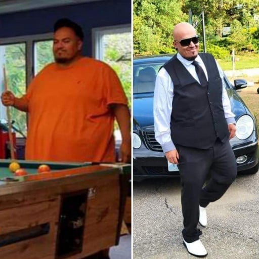 A before and after photo of a 5'8" male showing a weight reduction from 405 pounds to 240 pounds. A respectable loss of 165 pounds.