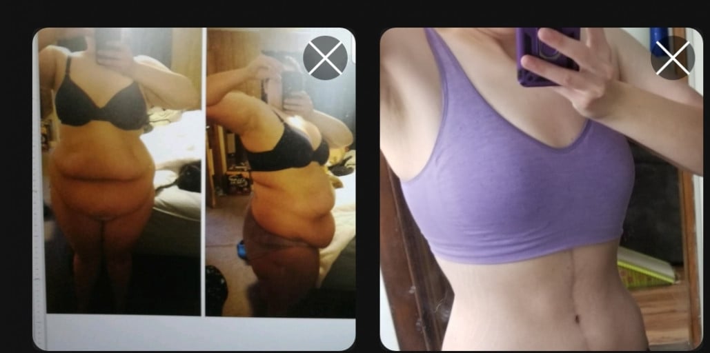 F/32/5'8" [310>160=150] (36 months) Weight loss surgery in 2018, skin removal in 2019. Now I'm working on some sweet, sweet muscle