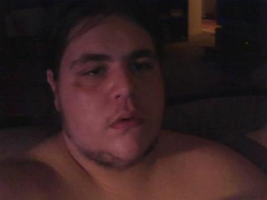 110 lbs Fat Loss Before and After 6 foot 1 Male 380 lbs to 270 lbs