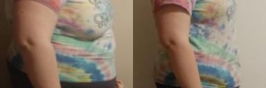 5 feet 8 Female Progress Pics of 120 lbs Fat Loss 373 lbs to 253 lbs