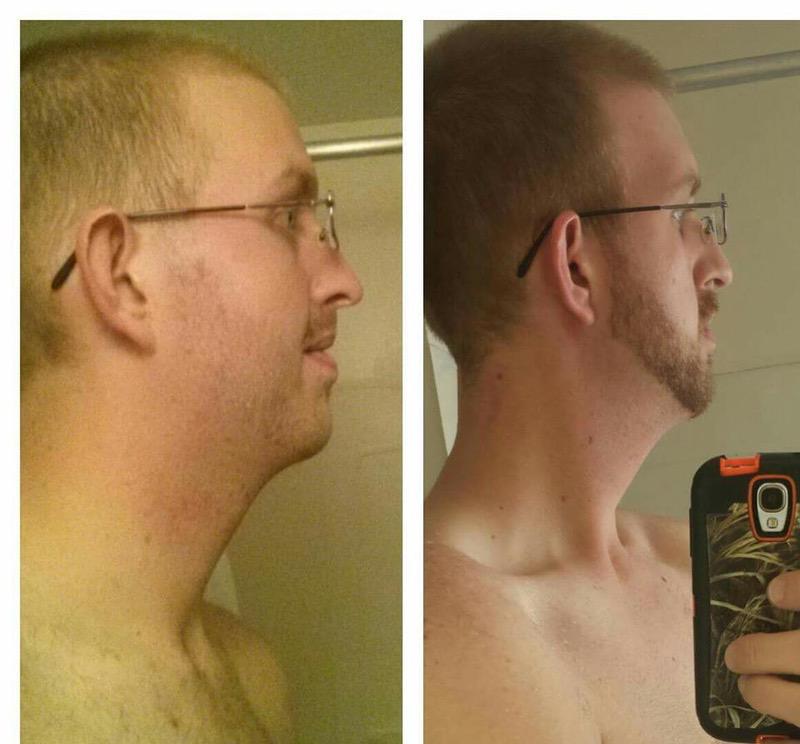 84 lbs Weight Loss 6'7 Male 325 lbs to 241 lbs