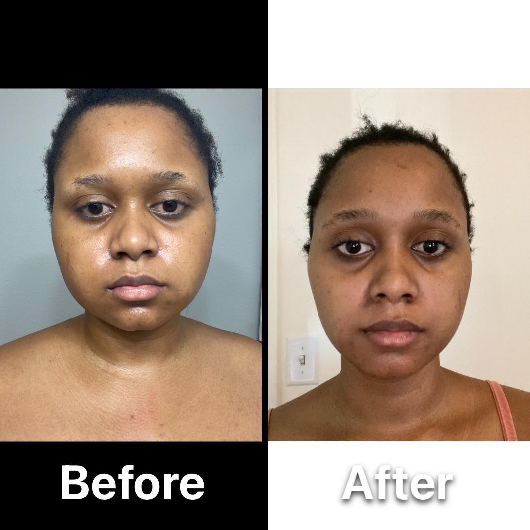 Progress Pics of 61 lbs Fat Loss 5 foot 4 Female 226 lbs to 165 lbs