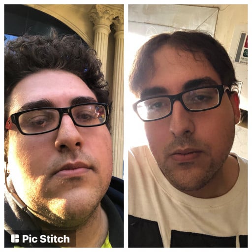 Before and After 136 lbs Weight Loss 6 foot Male 430 lbs to 294 lbs