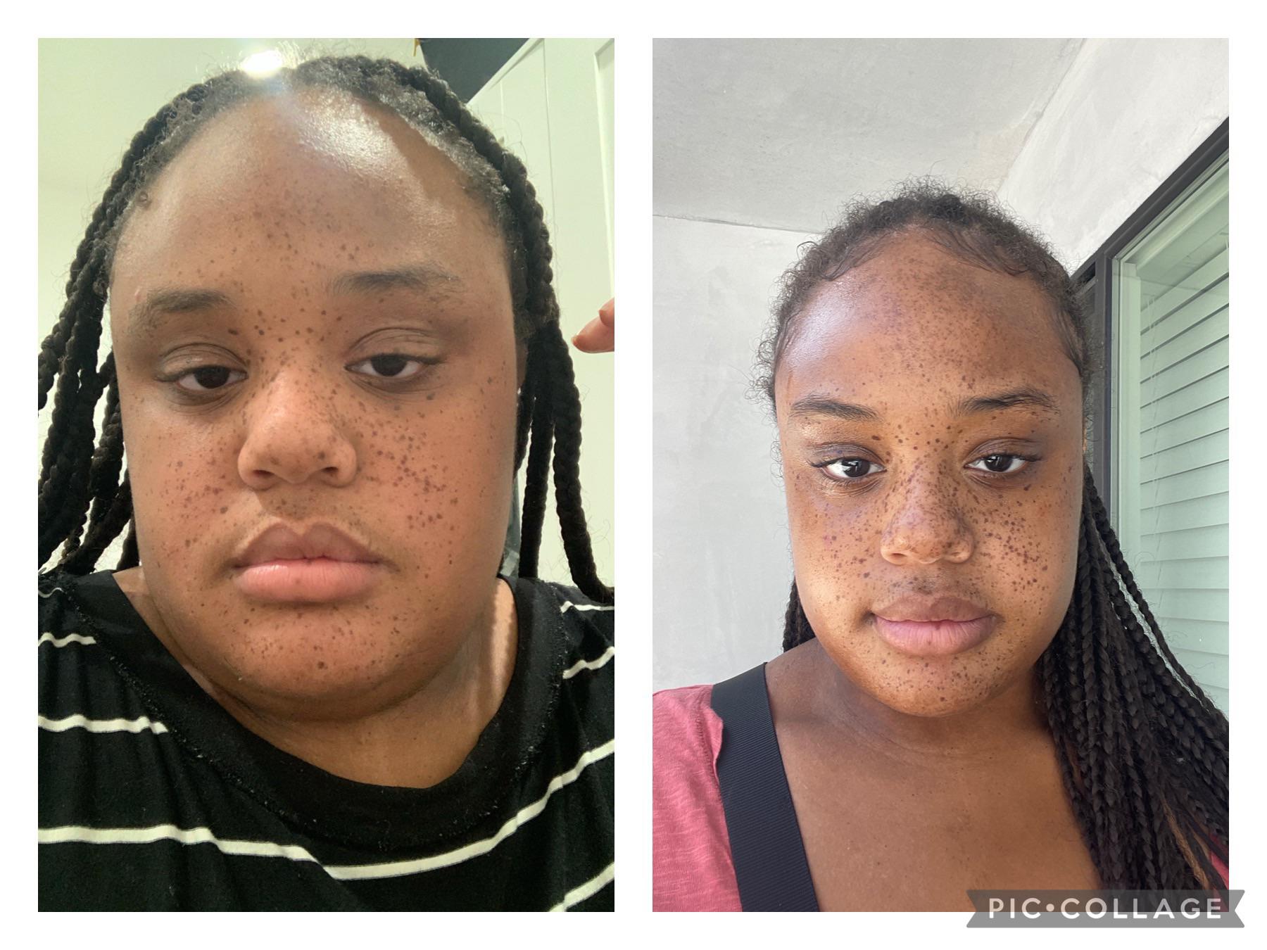 Before and After 95 lbs Fat Loss 5 foot 9 Female 325 lbs to 230 lbs