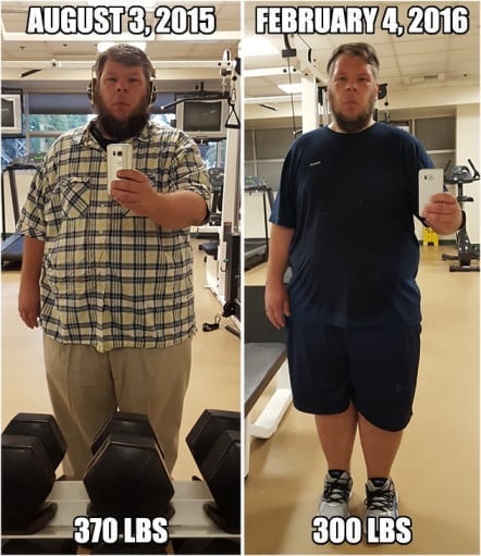 A before and after photo of a 5'10" male showing a weight reduction from 370 pounds to 300 pounds. A respectable loss of 70 pounds.