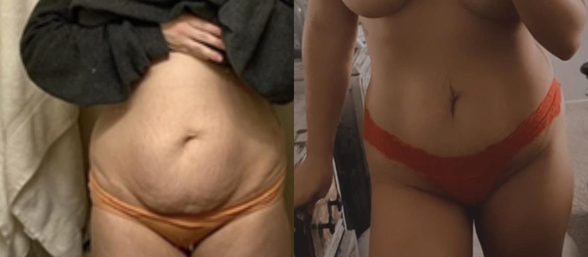 17 lbs Fat Loss Before and After 5'2 Female 154 lbs to 137 lbs