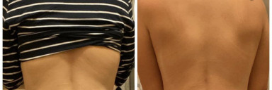 Progress Pics of 4 lbs Fat Loss 5 foot 5 Female 136 lbs to 132 lbs