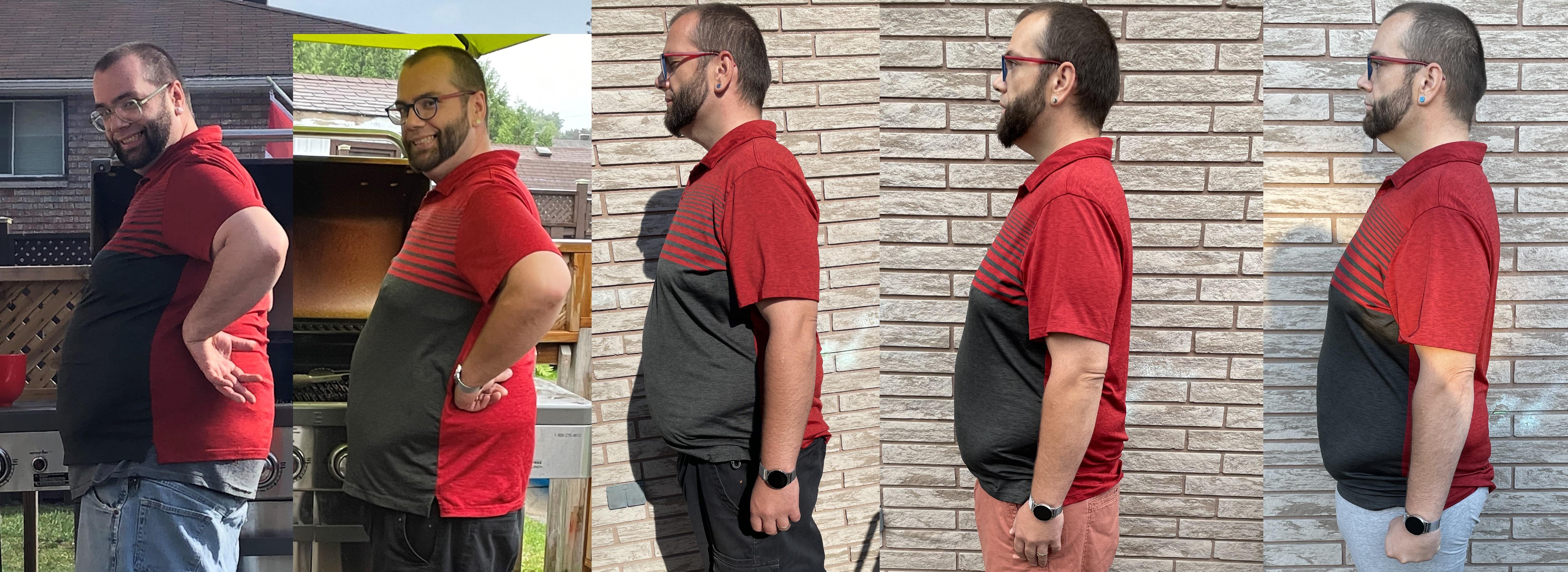 5 foot 10 Male 71 lbs Fat Loss Before and After 299 lbs to 228 lbs