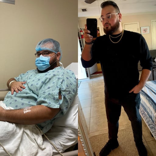 A picture of a 5'9" male showing a weight loss from 270 pounds to 230 pounds. A net loss of 40 pounds.