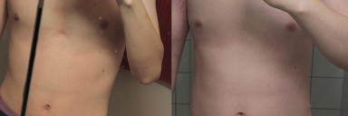 6 foot Male 76 lbs Muscle Gain Before and After 117 lbs to 193 lbs