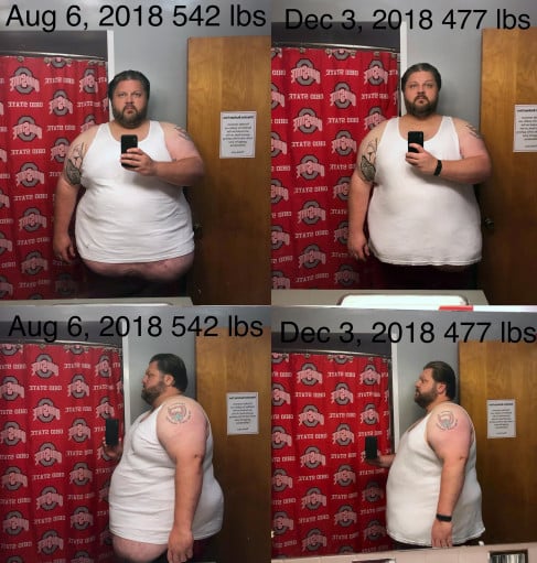 6 foot 1 Male Progress Pics of 65 lbs Weight Loss 542 lbs to 477 lbs