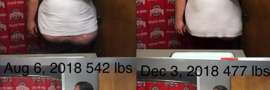 6 foot 1 Male Progress Pics of 65 lbs Weight Loss 542 lbs to 477 lbs