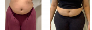 60 lbs Weight Loss Before and After 5 feet 7 Female 303 lbs to 243 lbs