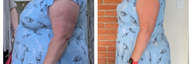 40 lbs Weight Loss Before and After 5 foot 4 Female 260 lbs to 220 lbs