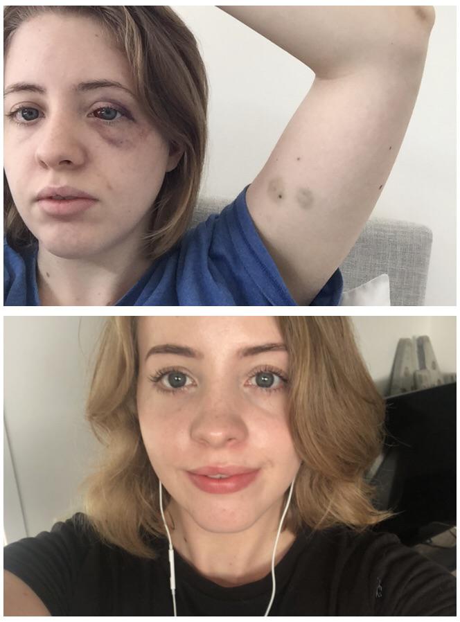 5 foot 4 Female 12 lbs Weight Loss Before and After 145 lbs to 133 lbs