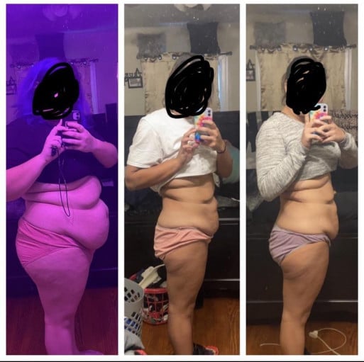 A before and after photo of a 5'7" female showing a weight reduction from 328 pounds to 203 pounds. A net loss of 125 pounds.