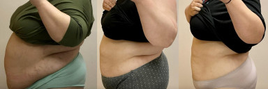 Before and After 50 lbs Fat Loss 5'3 Female 270 lbs to 220 lbs